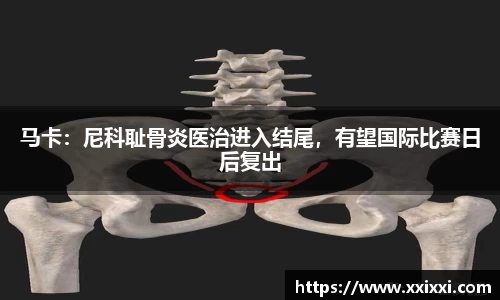 马卡：尼科耻骨炎医治进入结尾，有望国际比赛日后复出